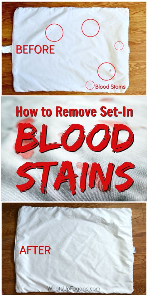 fake blood out of clothes|how to remove dried blood from fabric.